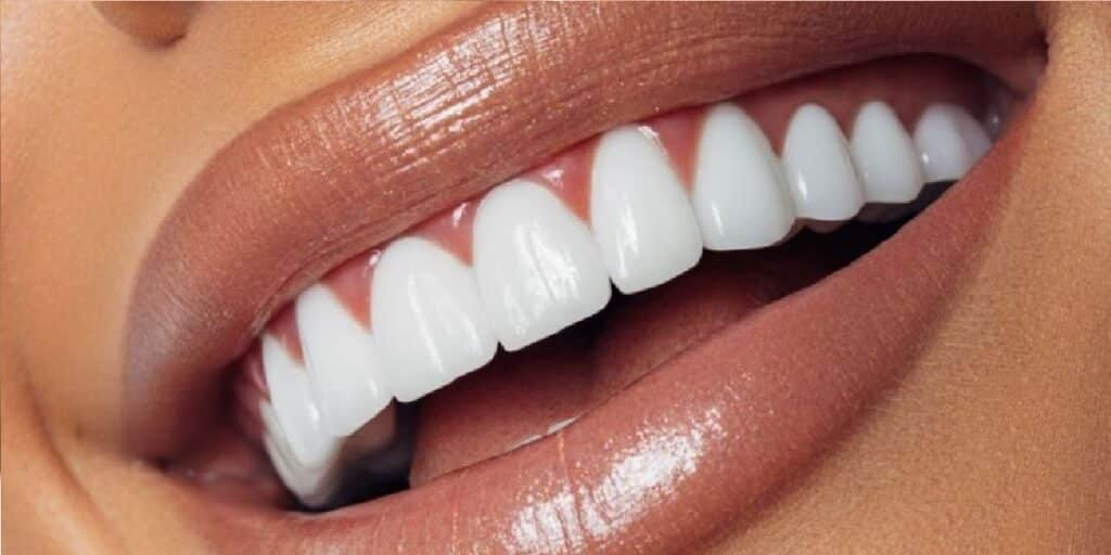 2 receitas IMBATÍVEIS para clarear os dentes em 5 minutos