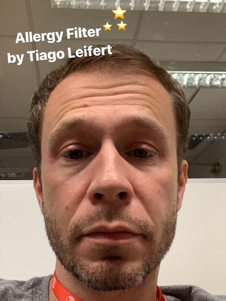 Tiago Leifert teve ataque de alergia (Foto: Reprodução/ Instagram)