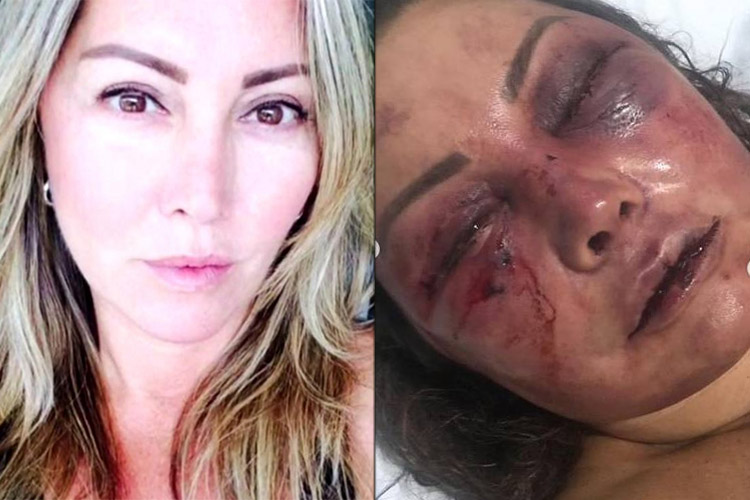 Mulher que foi agredida por quatro horas ganhará reportagem no Domingo Espetacular, da Record (Foto: Montagem)