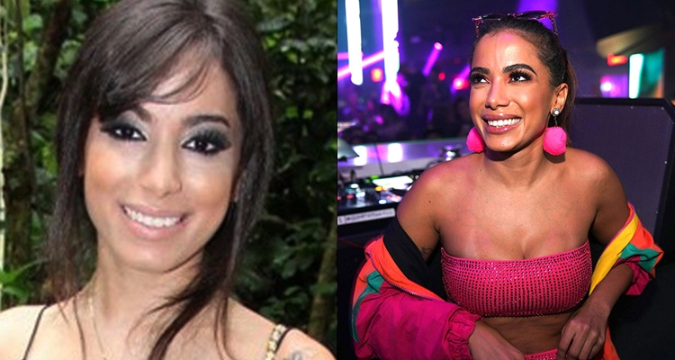 Anitta e seu antes e depois 