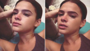 Bruna Marquezine foi diagnosticada com grave doença (Foto: Reprodução)