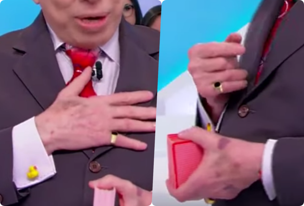 Marcas roxas nas regiões das mãos de Silvio Santos estão chamando a atenção no SBT