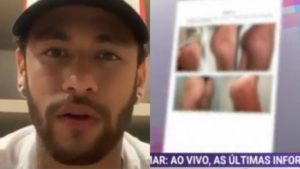 Vazam imagens de hematomas de supost vítima de Neymar após agressão (Imagens: Montagem/TV Foco)