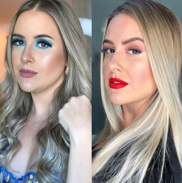 Patrícia Leitte antes e depois da cirurgia (Foto: Reprodução/ Instagram)