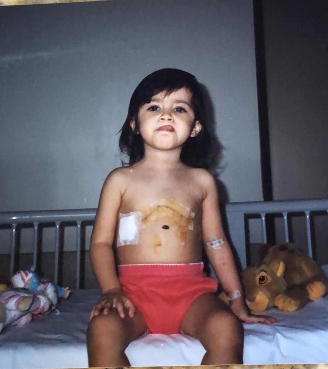 Jéssica Costa publicou foto na infância após cirurgia cardíaca (Foto: Reprodução/Instagram)