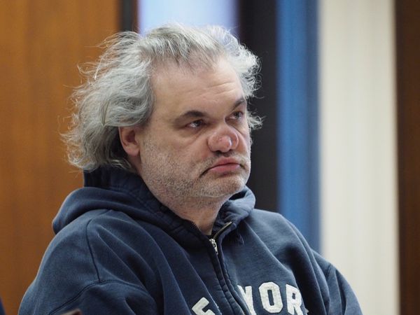 Artie Lange fica totalmente sem nariz após polêmica com drogas (Foto: Reprodução)