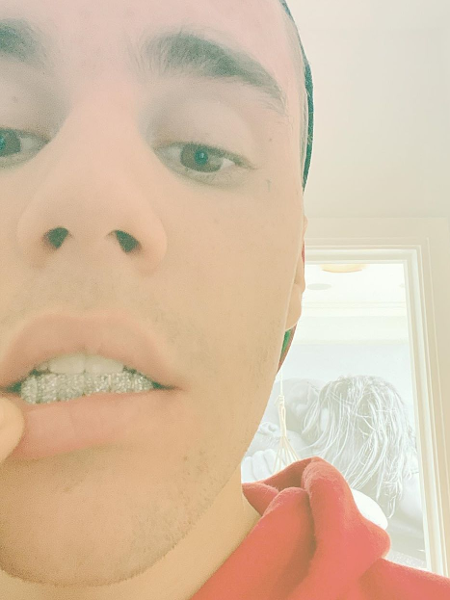 Justin Bieber posta foto com placa de diamante nos dentes (Foto: Reprodução)