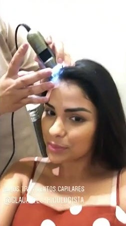 Ex- BBB Munik Nunes abre o jogo sobre agravante que surgiu após cirurgia estética (Foto: Reprodução)