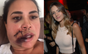 Influencer é brutalmente atacada por modelo (Foto: Reprodução)