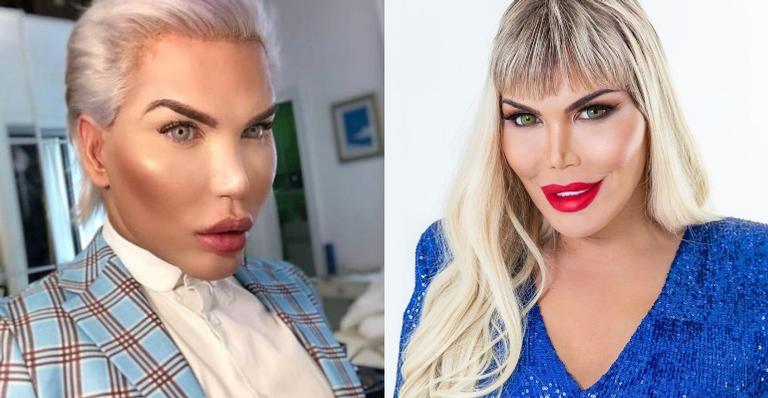 Rodrigo Alves, o Ken Humano, passa por transição de gênero (Foto: Reprodução)