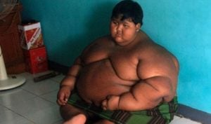 Aria Permala, considerada a criança mais gorda do mundo, passa por tranformação radical e surpreende com resultados (Foto: Reprodução)