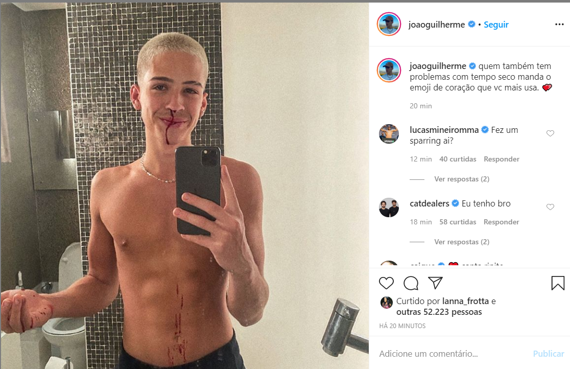 João Guilherme roubou a cena e preocupou fãs com o nariz sangrando (Foto: Reprodução / Instagram) leoardo ze felipe
