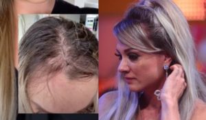 Juju Salimeni mostra queda de cabelo (Foto: Reprodução/Montagem)