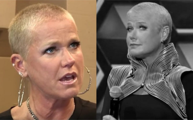 Xuxa expõe que fez cirurgia plásticas e revela procedimentos secretos