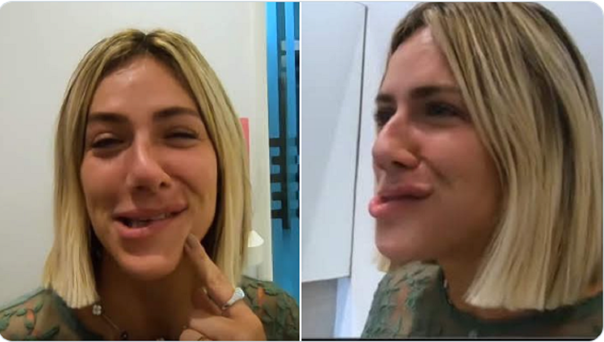 A atriz e apresentadora Giovanna Ewbank apareceu com o rosto todo torto depois de passar pelo dentista (Foto: Reprodução)