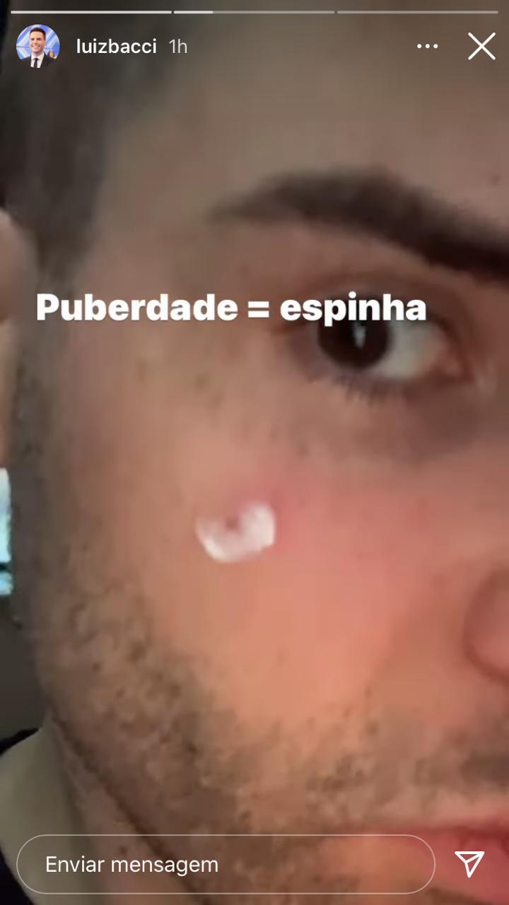 Luiz Bacci mostrou espinha aos fãs (Foto: Reprodução/Instagram)