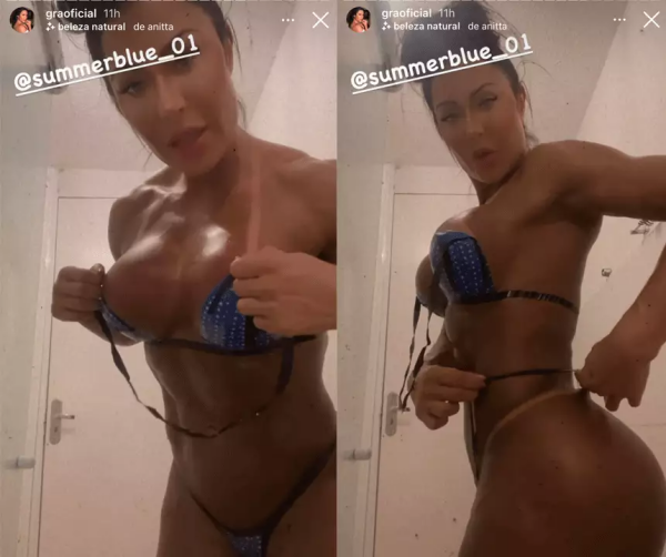 Gracyanne Barbosa exibindo o seu corpo todo malhado e bronzeado após um bronzeamento artificial (Imagem: Montagem)