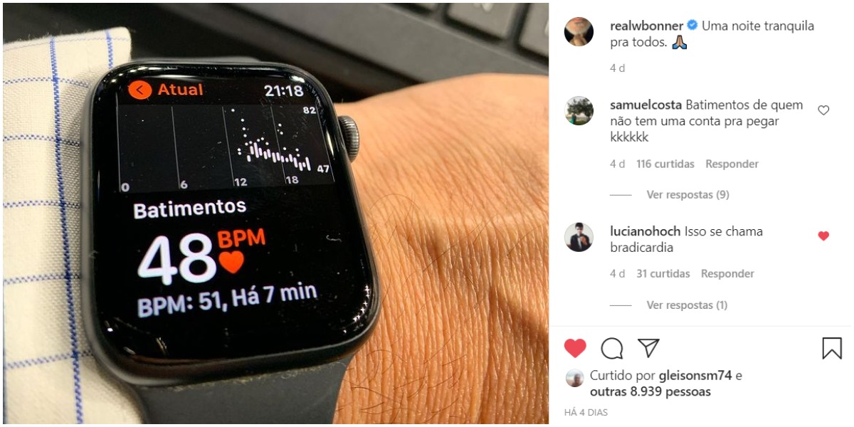 Apple Watch de William Bonner causou discussões - Foto: Reprodução