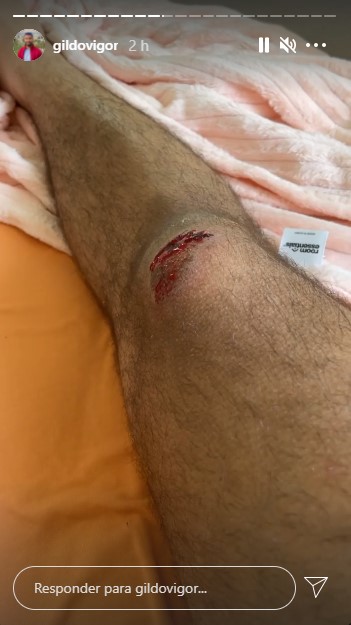 Gil do Vigor sofre acidente de bicicleta (Foto: Reprodução)
