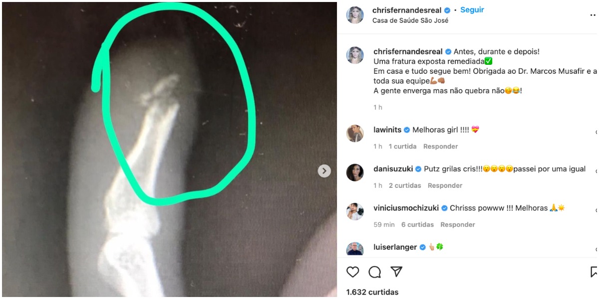 Christiane Fernandes surpreendeu com post - Foto: Reprodução