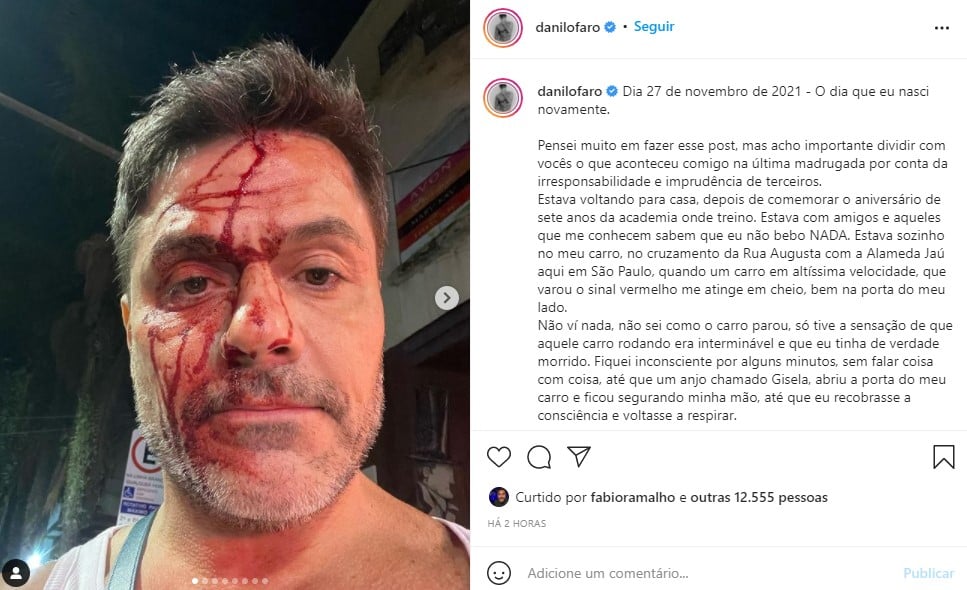 Irmão de Rodrigo Faro surgiu com o rosto coberto por sangue (Foto: Reprodução)