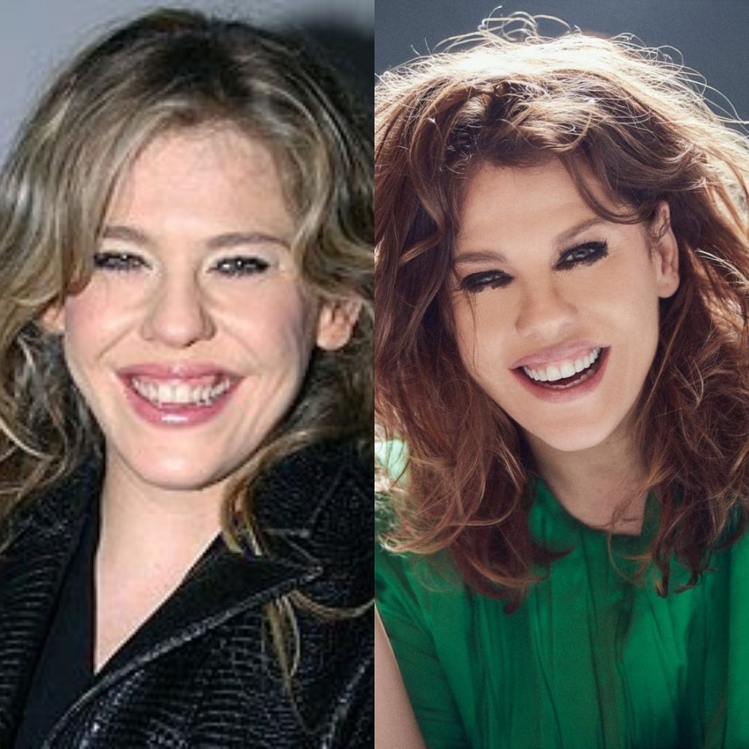 Bárbara Paz, antes e depois de mudar sorriso