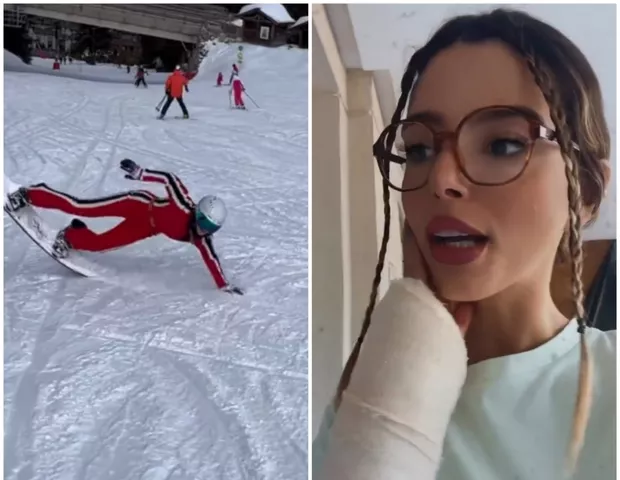 Giovanna Lancellotti se machucou enquanto esquiava (Foto: Reprodução/ Instragram)