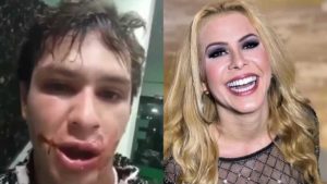 Adeildo B. foi agredido após show de Joelma, em Manaus (Foto: Reprodução)