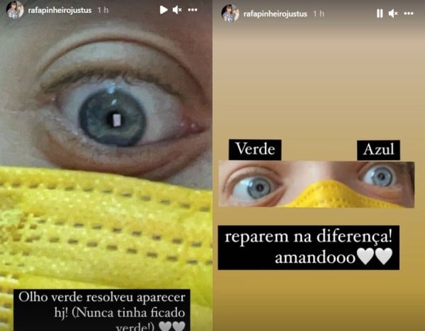 Rafaella Justus, filha de Ticiane Pinheiro, mostra diferença dos olhos em foto no Instagram (foto: Instagram)