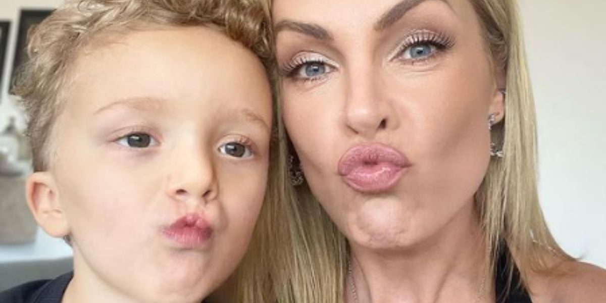 Ana Hickmann mostra antes e depois do sobrinho que nasceu com lábio leporino - Foto: Reprodução Instagram