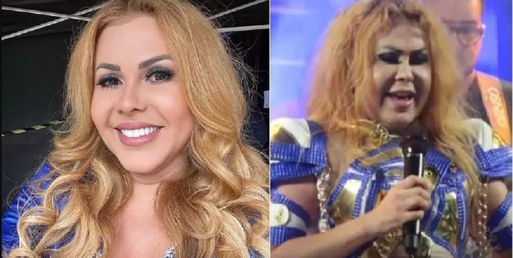 Joelma passou a noite no hospital e recebeu um diagnóstico após surgir completamente inchada