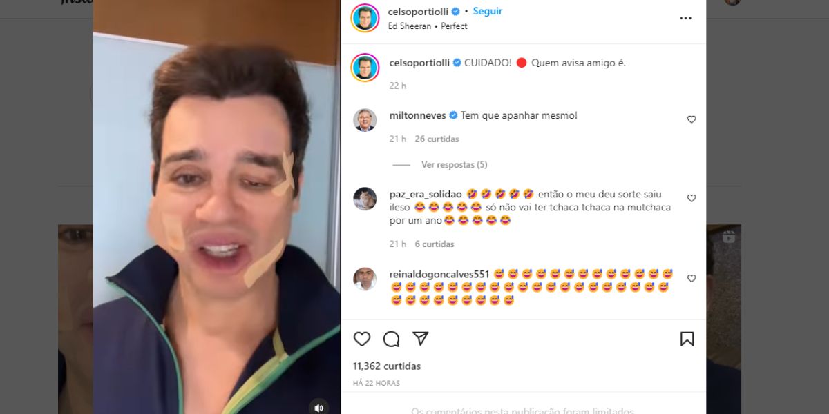 "Cuidado", Celso Portiolli surge com rosto todo deformado em vídeo, expõe surra e motivo: "Nunca esqueça"