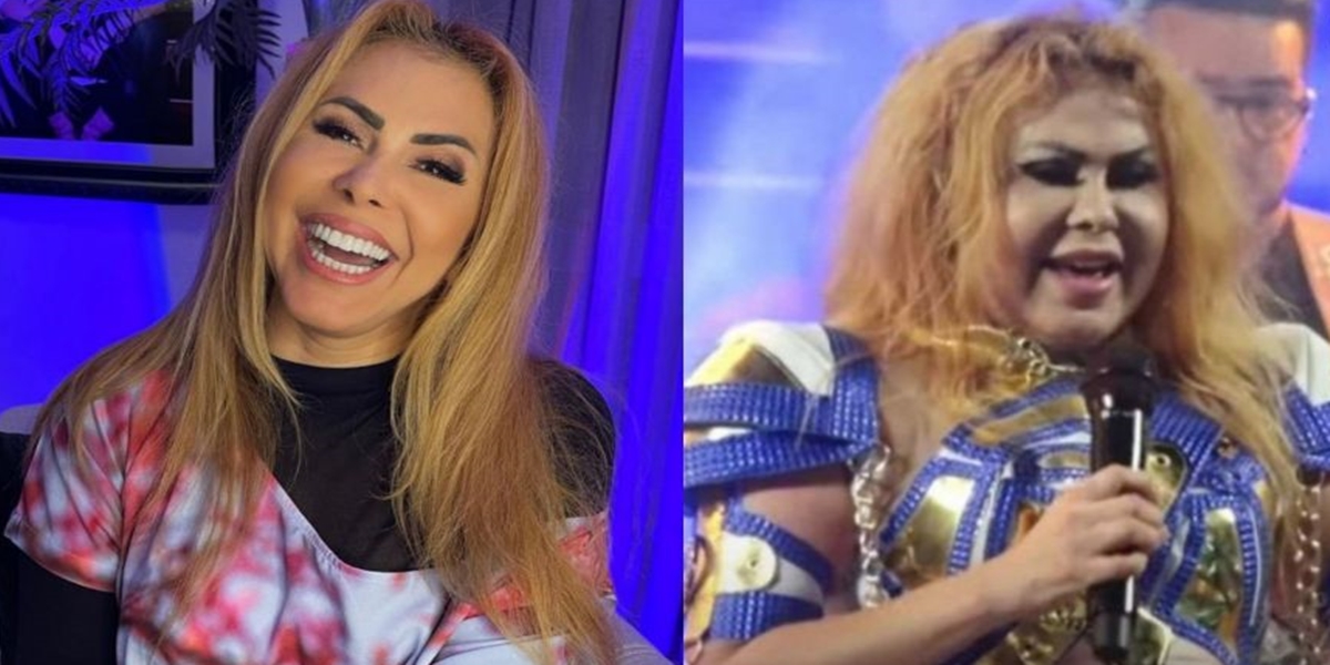 Joelma com rosto inchado (Foto: Montagem) 