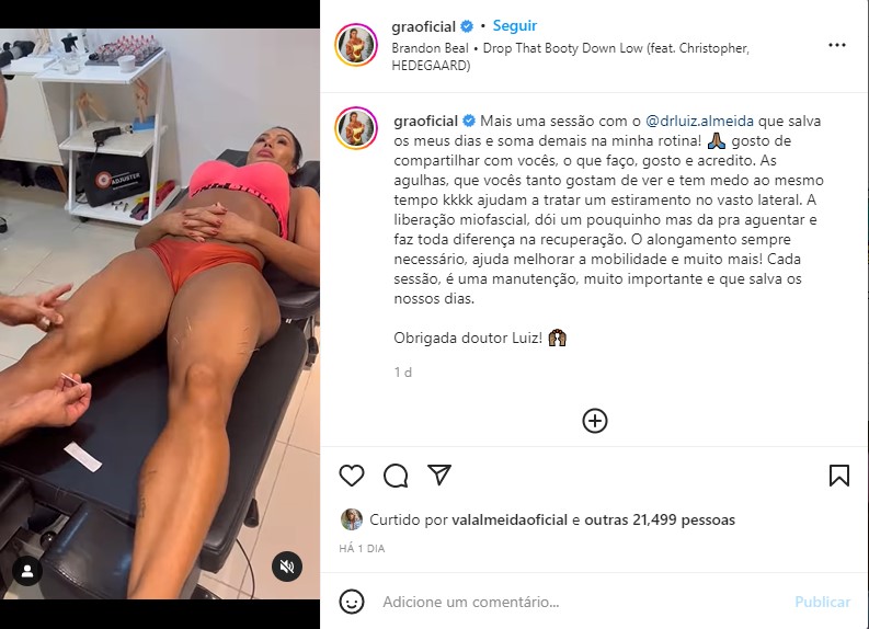 Gracyanne Barbosa expõe tratamento com agulhas - Foto: Reprodução