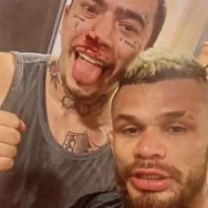 Whindersson Nunes após levar soco no rosto e sangrar (Reprodução - Instagram)