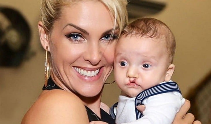 Ana Hickmann em foto com o sobrinho com lábios leopoldino (Foto: Reprodução)