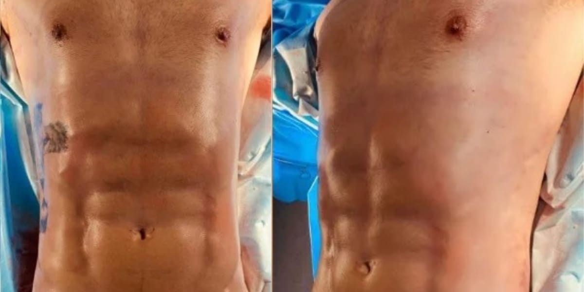 Novo visual do corpo de Caio Afiune após a cirurgia para corrigir ginecomastia (Reprodução: Instagram)