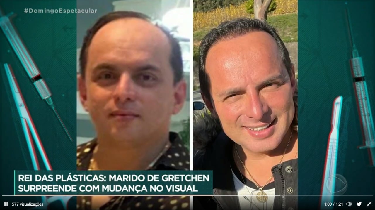 Antes e depois de Esdras Souza, marido de Gretchen (Foto: Reprodução/Record)