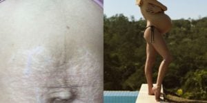 Isa Scherer, filha do Xuxa, mostra como ficou o corpo após procedimentos estéticos (Reprodução)