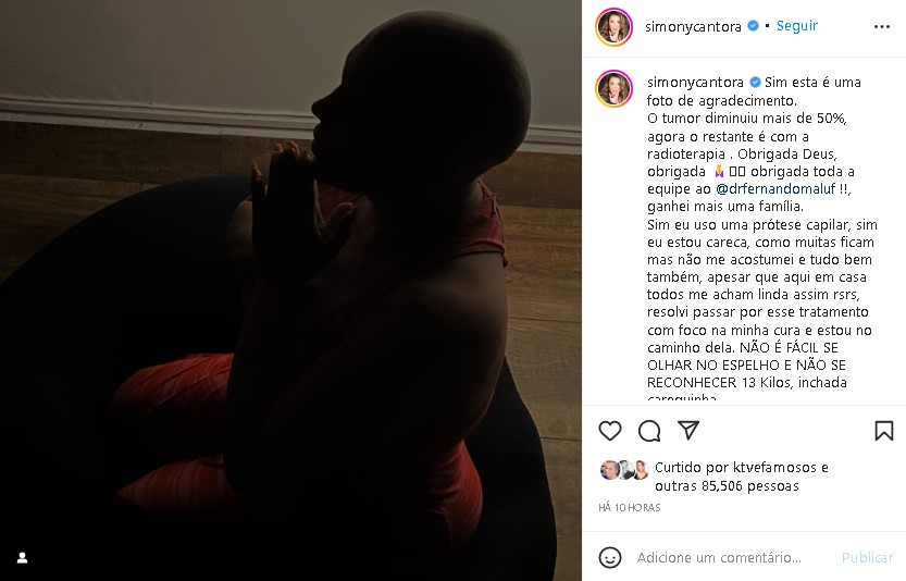 Simone, quien tiene cáncer, hizo un nuevo reportaje y sorprendió (Imagen: Instagram/Instagram)