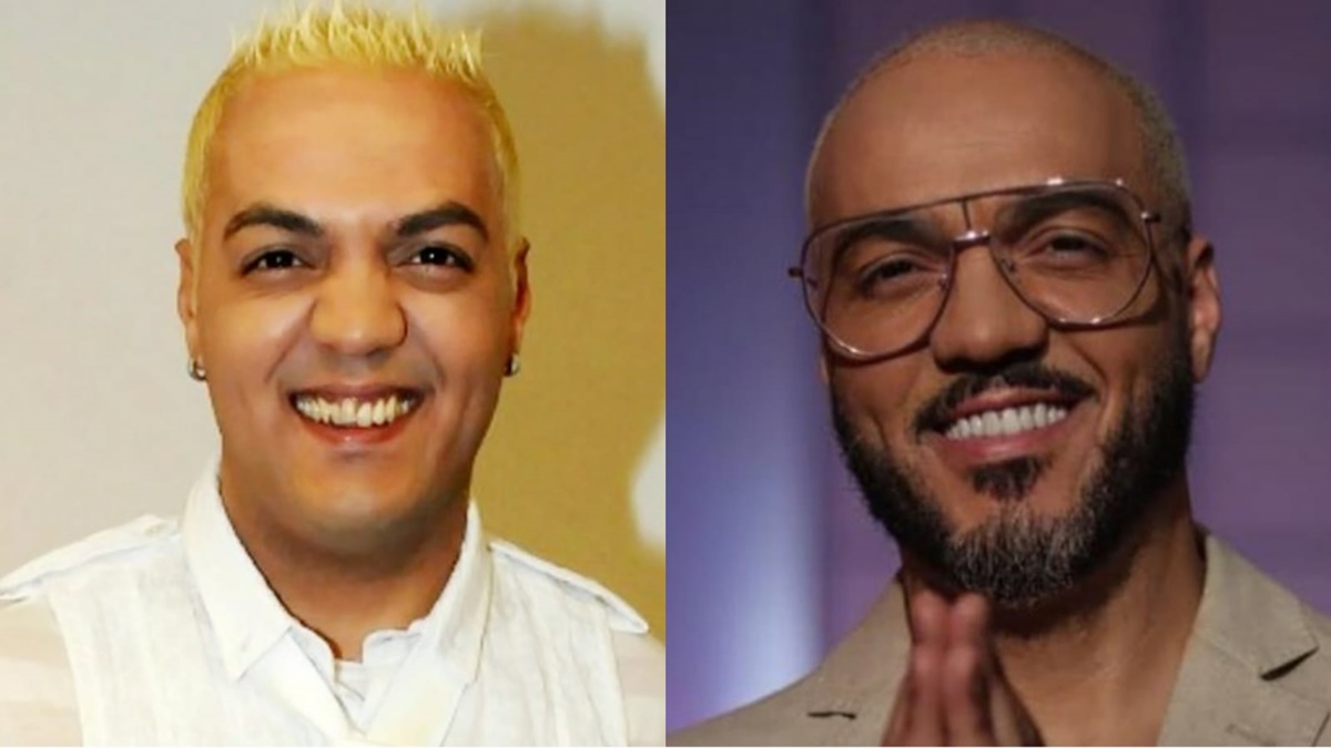 O cantor Belo antes e depois das lentes nos dentes (Reprodução)