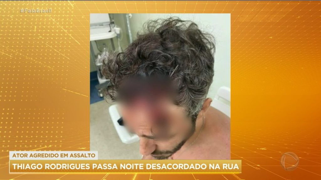 Fala Brasil mostrou a imagem de Thiago Rodrigues ensanguentado após um assalto violento- Foto: Reprodução/Record 