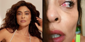 Juliana Paes surgiu com o olho muito inchado e causou preocupação (Foto: Reprodução)