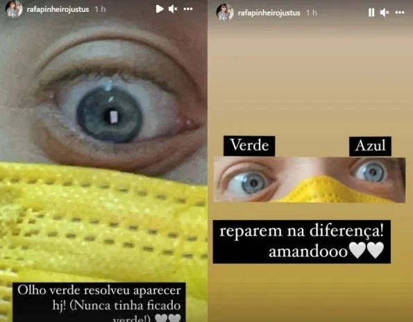 Rafinha Justos, filha de Tici Pinheiro e Roberto Justus, impressionou os seus seguidores ao mostrar linda mudança em seu rosto - Foto Reprodução Instagram