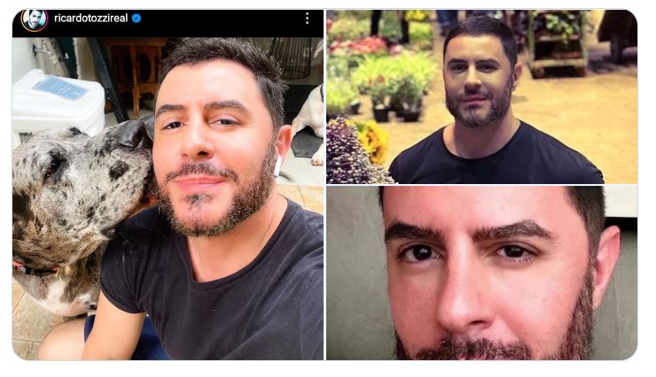 O famoso Ricardo Tozzi, da Globo, passa por procedimento no rosto e antes e depois choca a web - Foto Reprodução