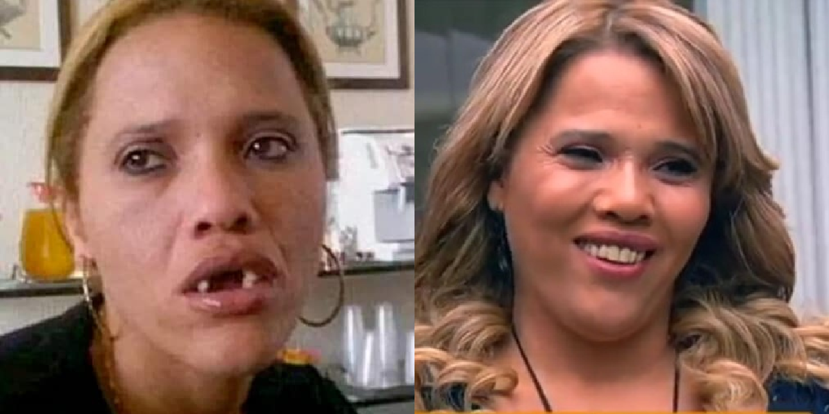 Antes e depois de Gorete (Foto: Divulgação)