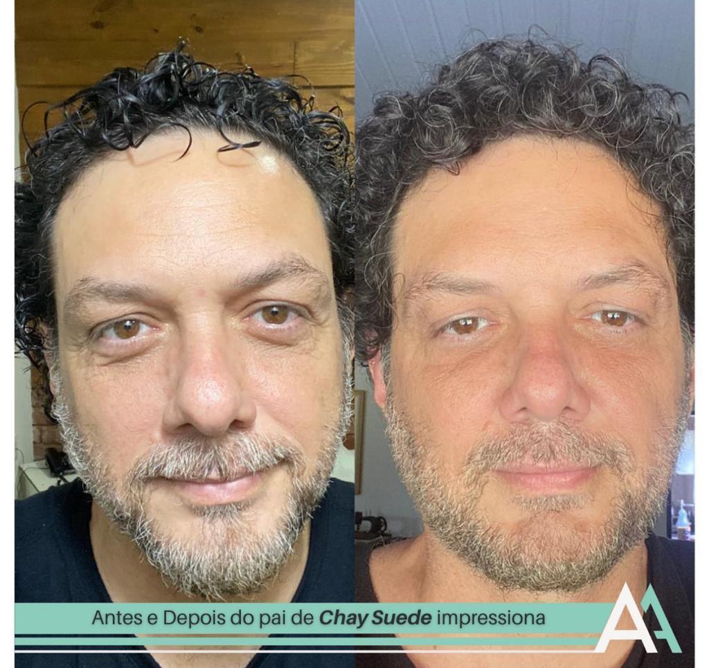 Pai de Chay Suede, antes e depois (Reprodução - instagram)