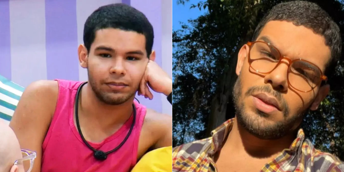 viny do BBB 22, antes e depois dos procedimentos no rosto - Foto: Reprodução