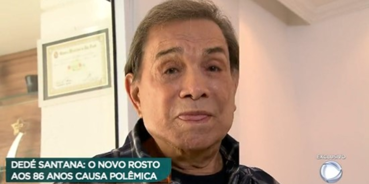 Dedé Santana mostra o novo rosto no Domingo Espetacular (Foto: Reprodução)