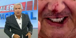 Sikêra Jr. surgiu debilitado nas redes sociais (Foto: Reprodução/RedeTV!/Instagram)